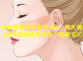 吸脂塑身手术副作 🌸 用大揭秘(关于吸脂塑形的几个误解 🐈 !)